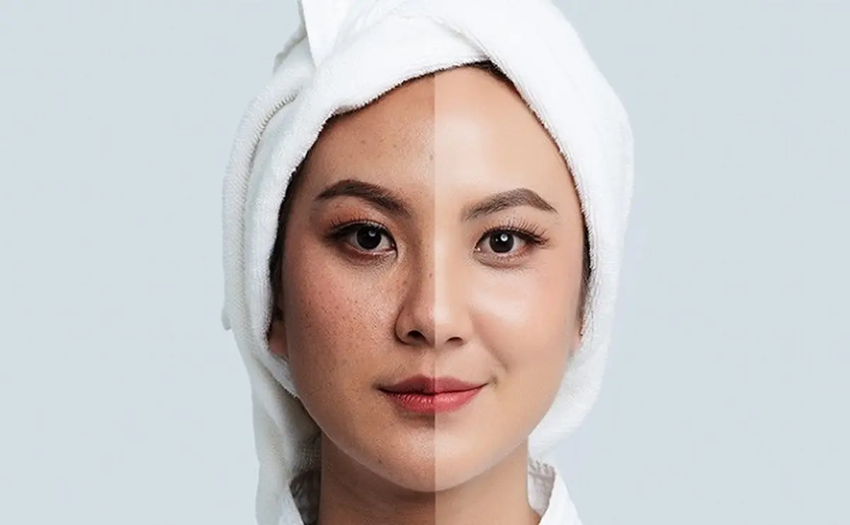 راه درمان لکه‌های پوستی مشخص شد