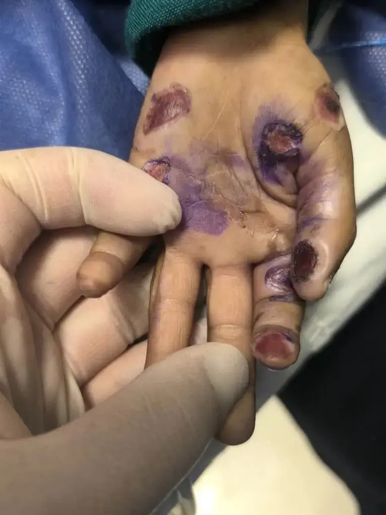 آزار و اذیت کودک