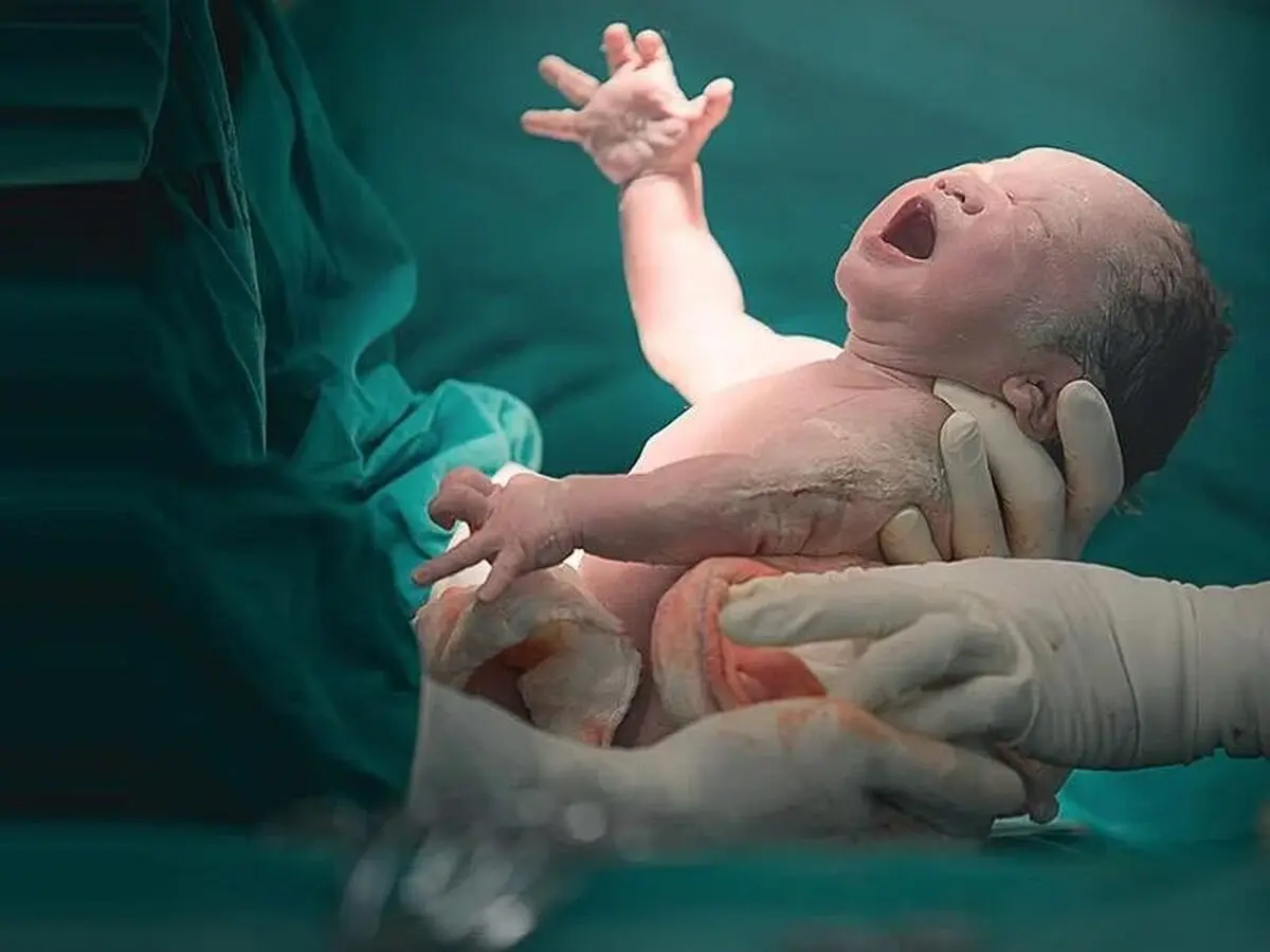 هزینه زایمان در بیمارستان‌های خصوصی سر به فلک کشید!