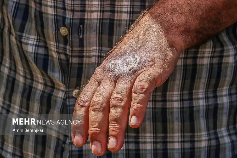 شیوع یک بیماری ترسناک و خطرناک در شیراز + تصاویر 16+ 