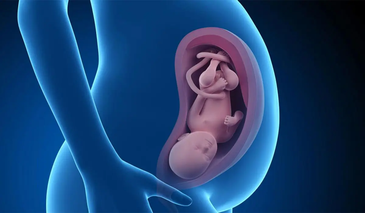 جلوگیری از بروز نقایص مادرزادی در جنین با این روش‌ها
