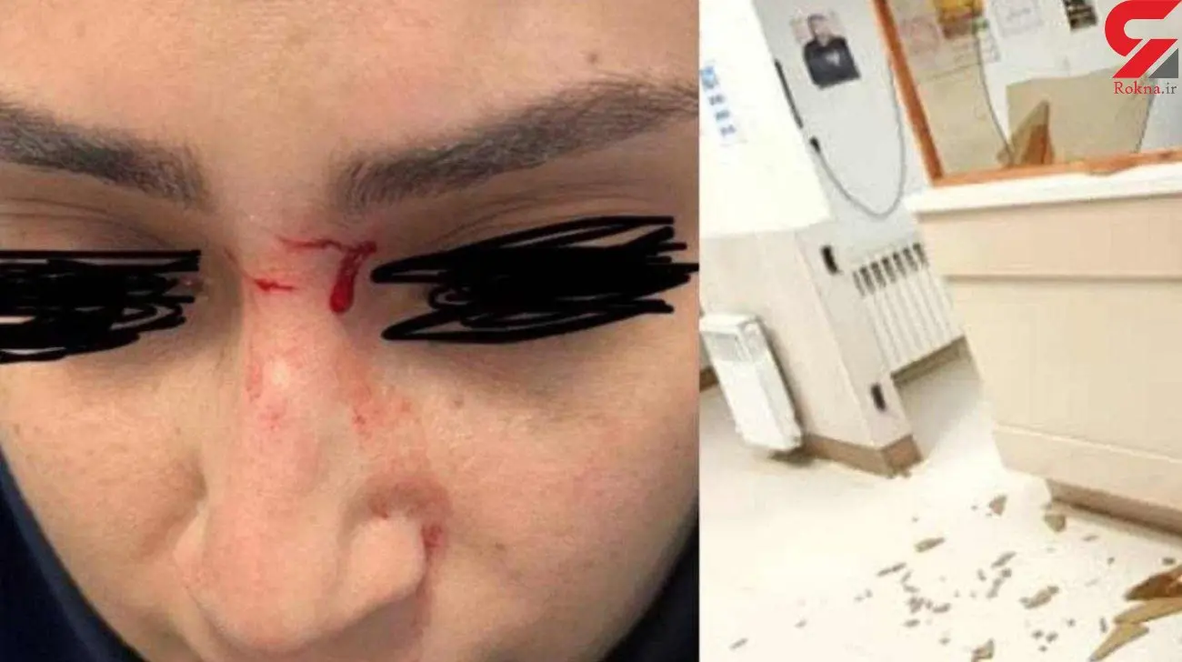 ضرب و شتم  دردناک یک خانم پرستار در تالش + عکس


