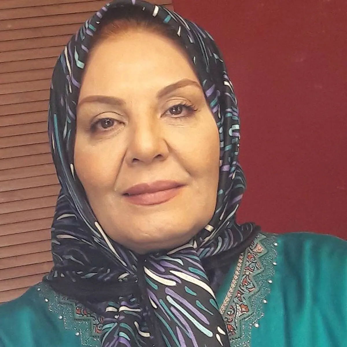 چهره زهره حمیدی بعد از شیمی درمانی

