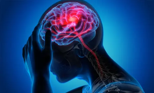 مضرات کار زیاد برای مغز