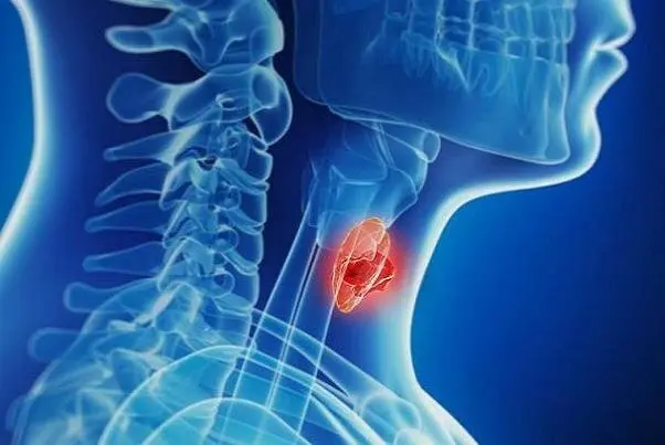 این عادت های اشتباه تاثیرات بدی روی تیروئیدتان می گذارد