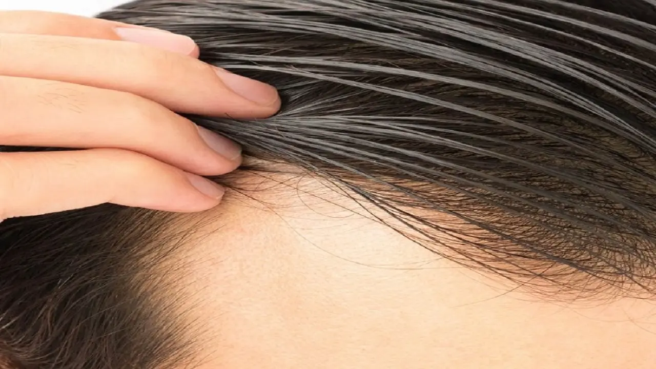 چگونه از آسیب دیدگی موها پیشگیری کنیم؟
