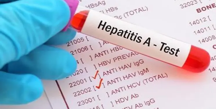 شیوع نگران کننده هپاتیت A در کودکان