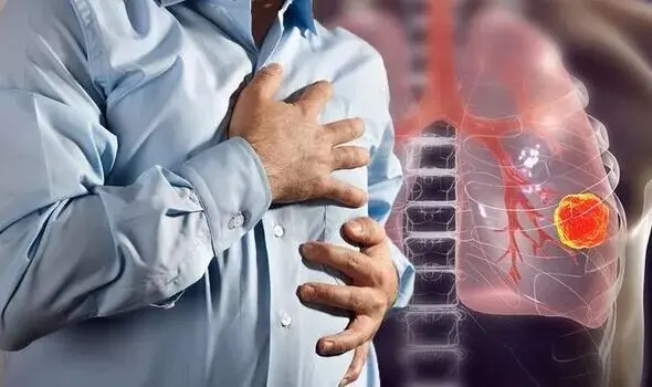 اگر می‌خواهید سرطان ریه نگیرید بخوانید