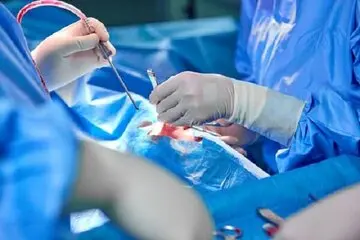 انجام اولین جراحی روی مغز دختر 12 ساله در ایران
