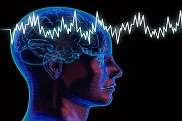 علائم ظاهری سکته مغزی چیست؟
