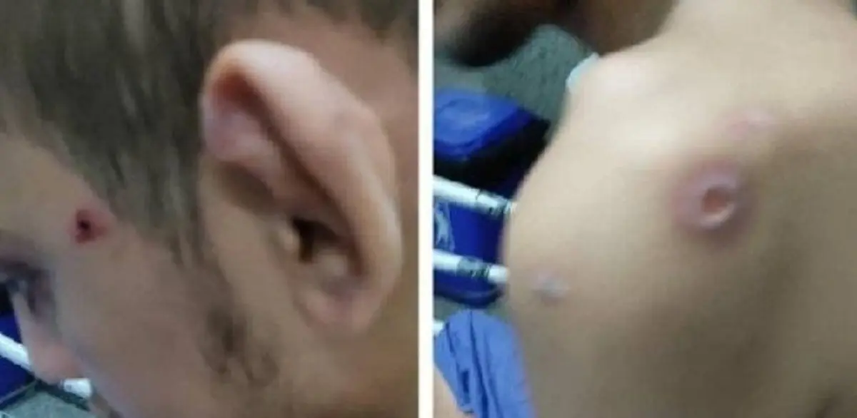 جرئیات جدید از ضرب‌وشتم و سوختگی فرد معلول در مرکز نگهداری قائم‌شهر 
