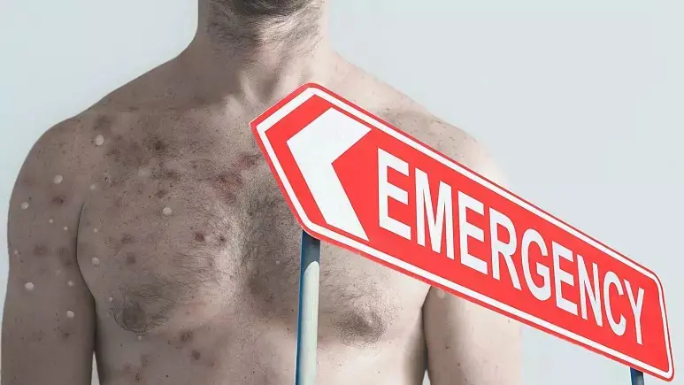 آنفولانزای گوجه فرنگی از چه طریقی منتقل می‌شود؟