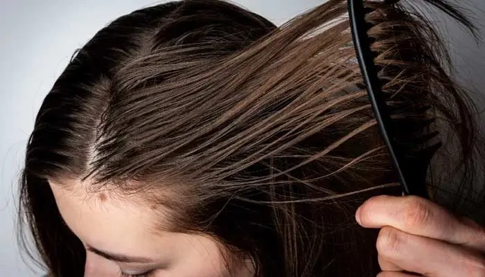 دلیل چرب شدن مو ها در دوران بارداری چیست؟