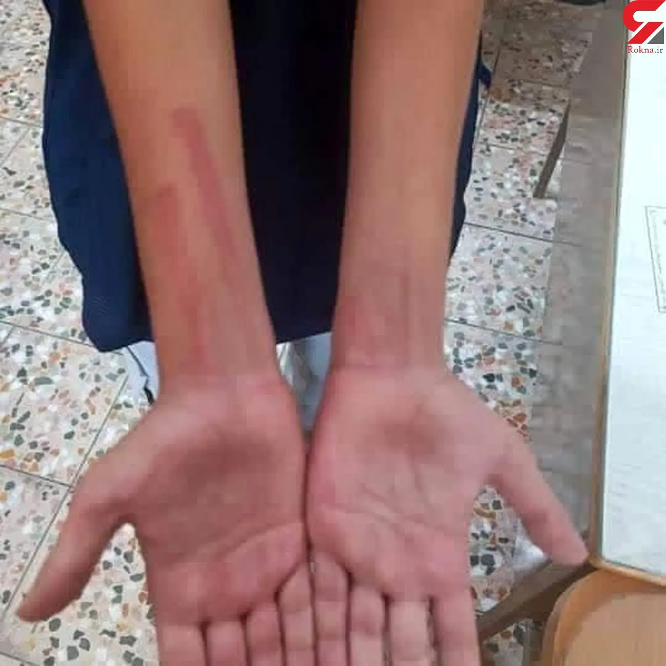 تنبیه بدنی یک دانش آموز در آستارا/ واکنش رسمی آموزش و پرورش