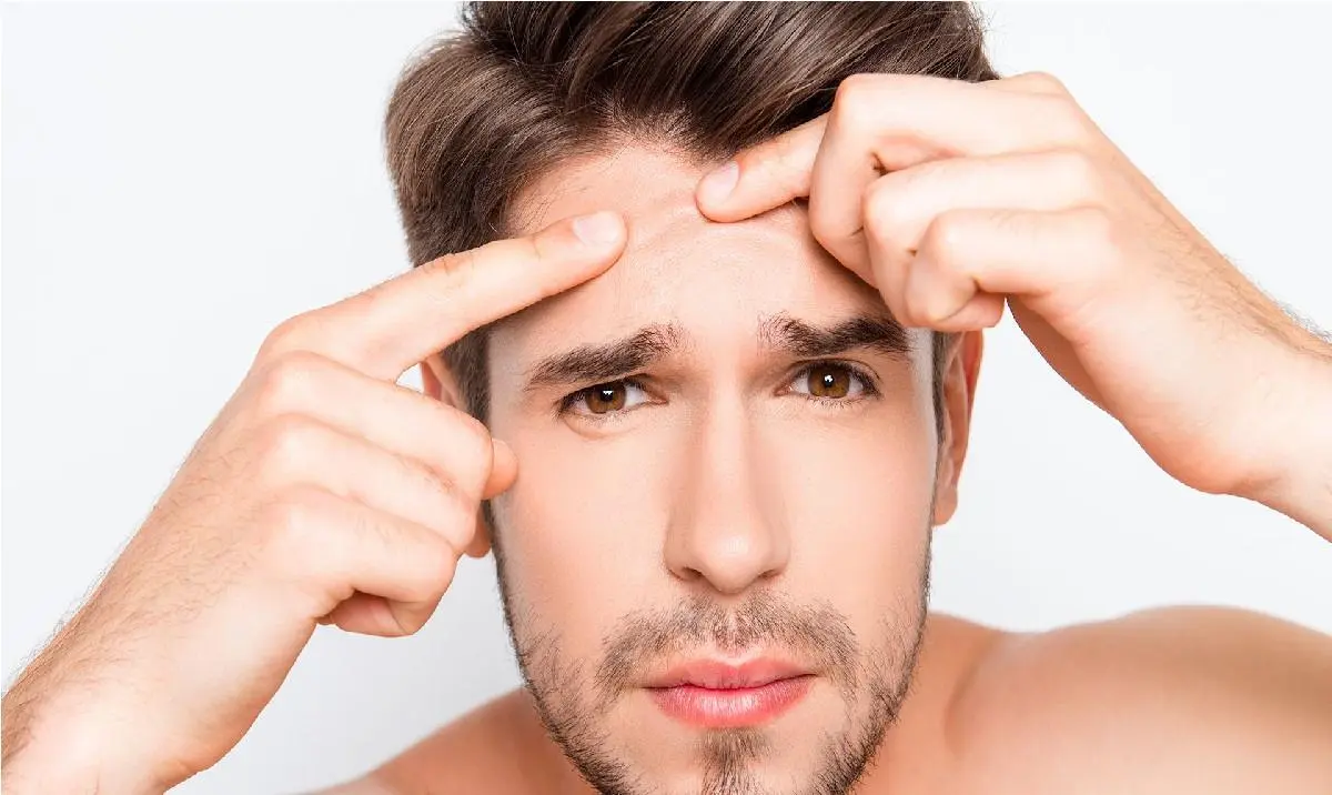 ترفندهای عالی برای از بین بردن جوش های صورت