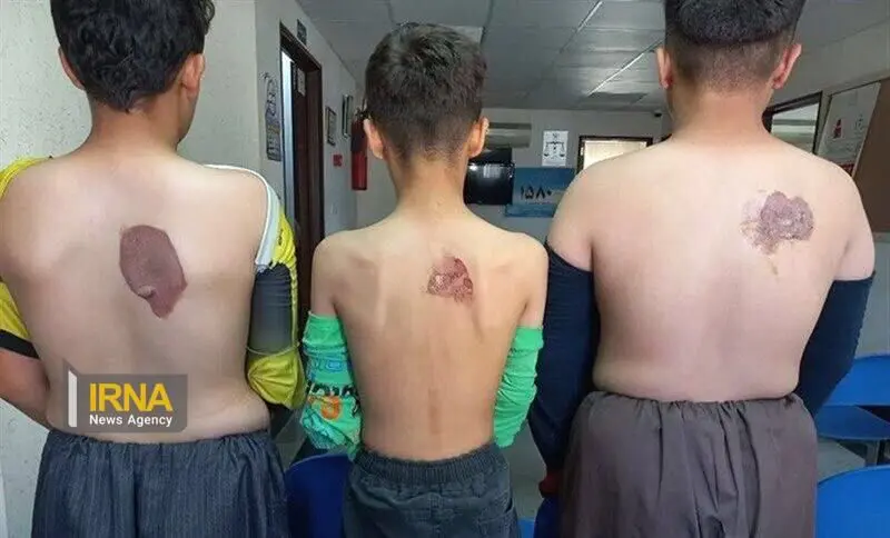 جزئیات وحشتناک از خیاطی که شاگردانش را با اتو داغ کرد

