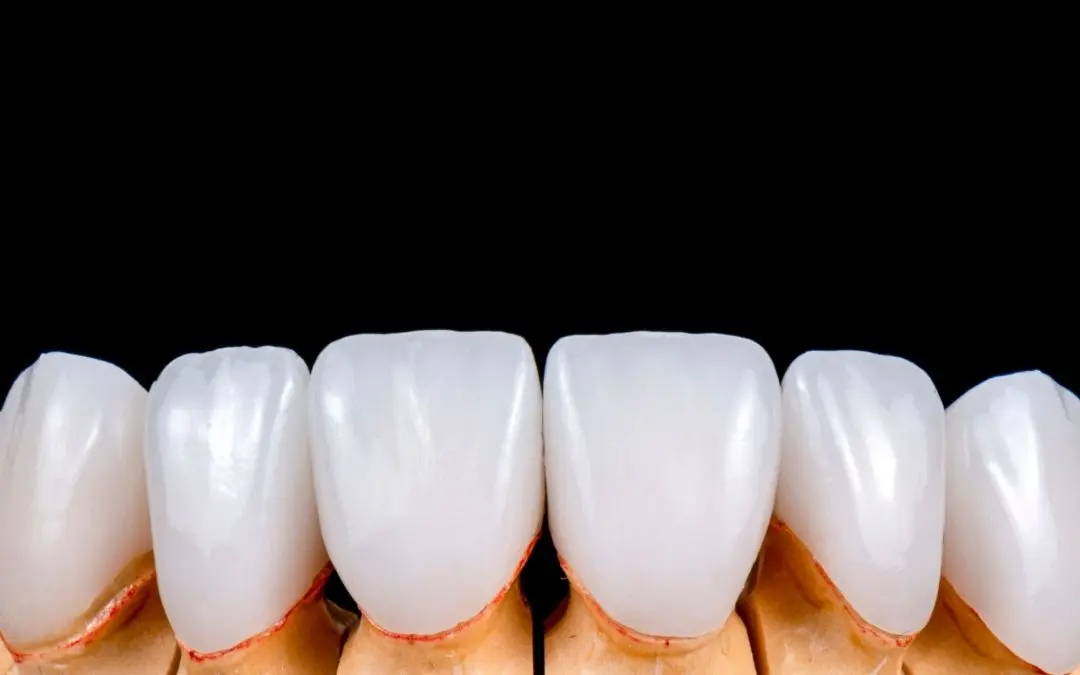 هزینه خدمات دندانپزشکی و دلایل گران بودن آن چیست؟
