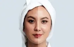 راه درمان لکه‌های پوستی مشخص شد