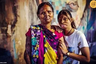 کافه قربانیان اسیدپاشی