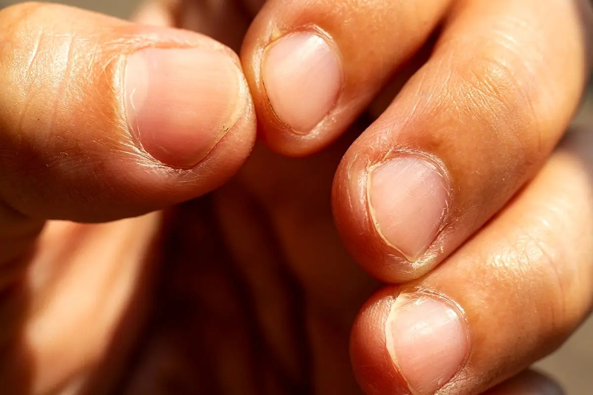 تأثیر یائسگی بر سلامت ناخن ها