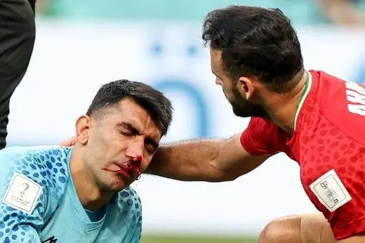 بیرانوند به بازی با ولز می رسد؟