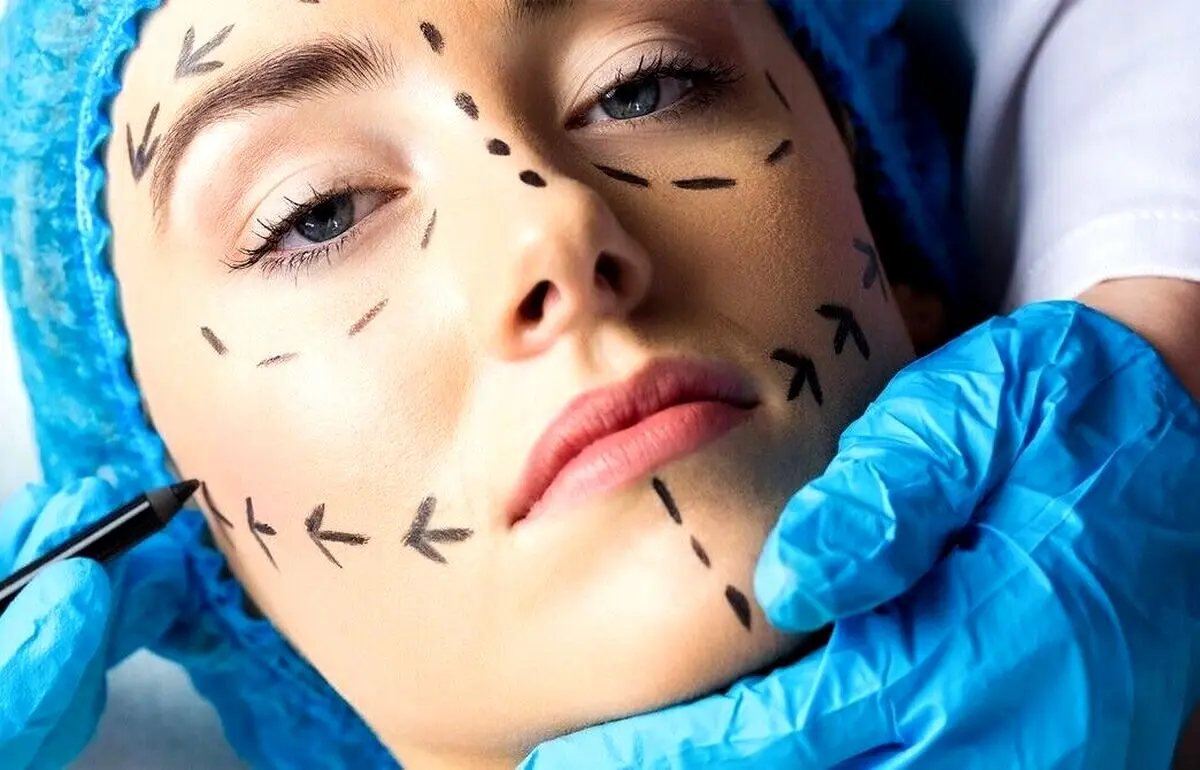 سن انجام عمل‌های زیبایی به زیر ۱۴ سال رسید


