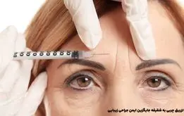 تزریق چربی به شقیقه جایگزین ایمن جراحی زیبایی
