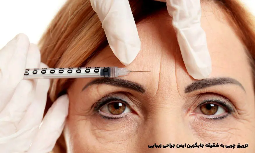 تزریق چربی به شقیقه جایگزین ایمن جراحی زیبایی