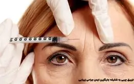 تزریق چربی به شقیقه جایگزین ایمن جراحی زیبایی