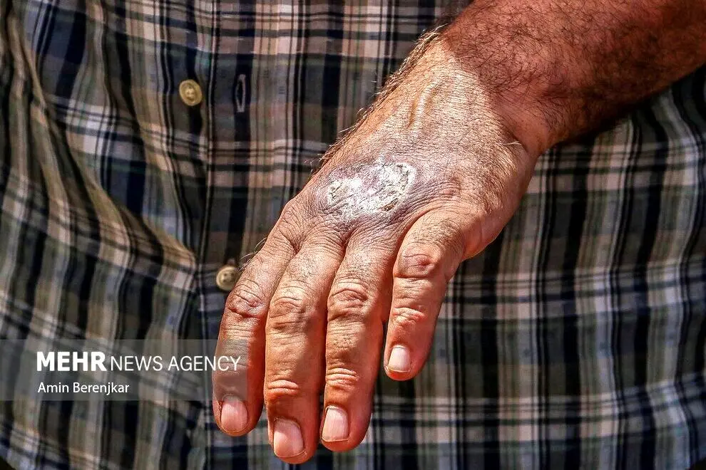 شیوع یک بیماری ترسناک و خطرناک در شیراز + تصاویر 16+ 