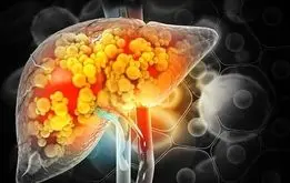 چربی‌هایی که برای مبتلایان به کبد چرب مفیدند