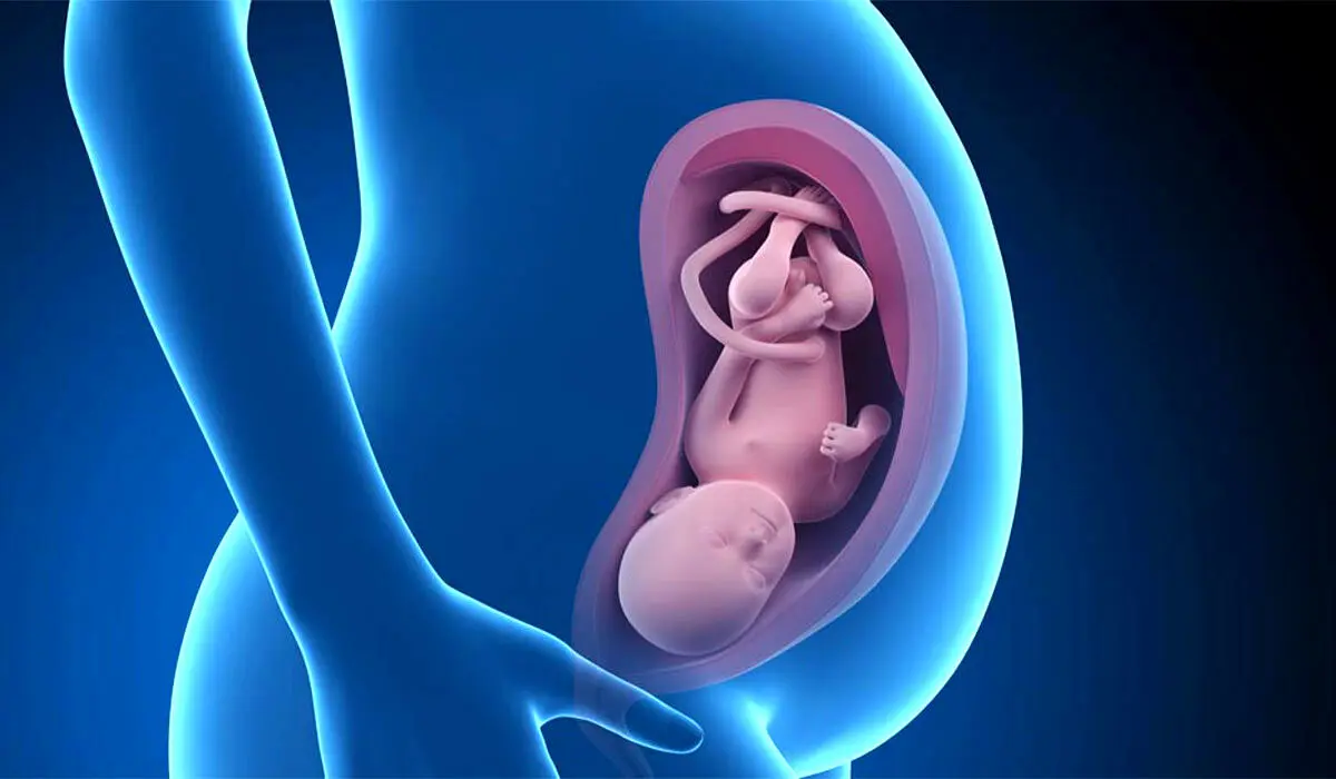 جلوگیری از بروز نقایص مادرزادی در جنین با این روش‌ها