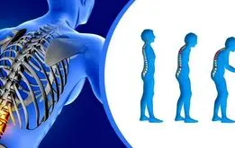ابتلا به پوکی استخوان با مصرف زیاد این نوشیدنی