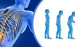 ابتلا به پوکی استخوان با مصرف زیاد این نوشیدنی