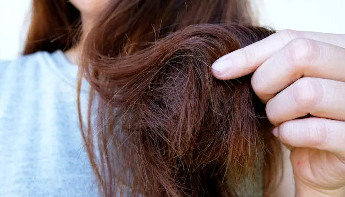 نازک شدن تار مو چه ربطی به چاقی دارد؟