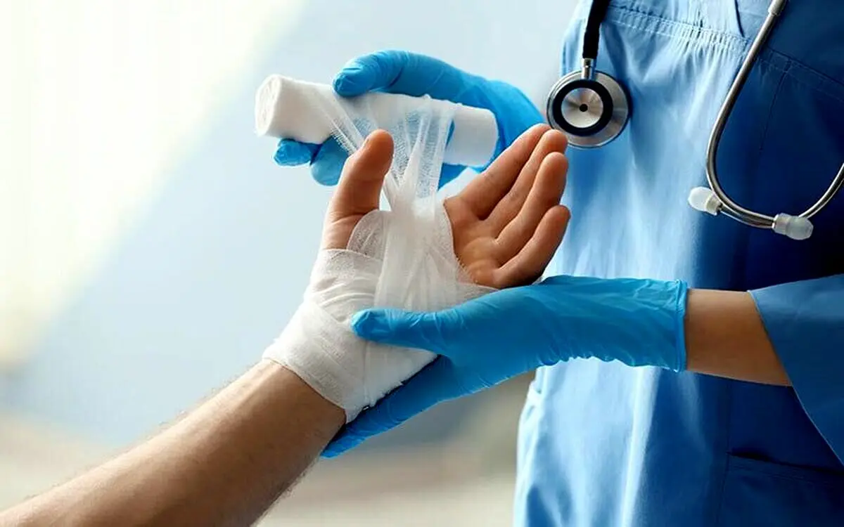 چند توصیه برای پیشگیری از سوختگی‌های خطرناک در چهارشنبه آخر سال