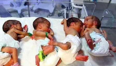 زن زاهدانی که چهار فرزند داشت، چهار قلو به دنیا آورد