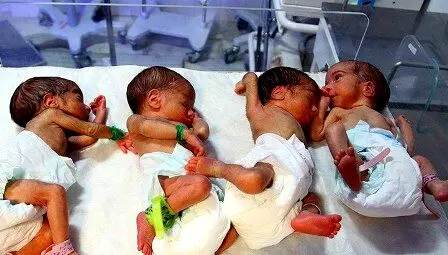 زن زاهدانی که چهار فرزند داشت، چهار قلو به دنیا آورد