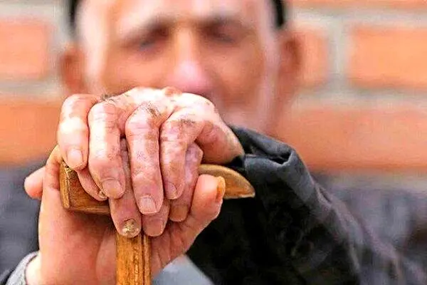 وضعیت ایران در بین پیرترین کشورهای جهان+تصویر

