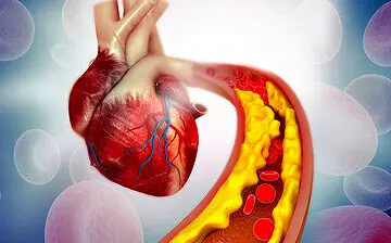 بهترین نوشیدنی برای کاهش کلسترول خون