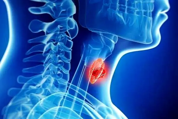 مهمترین علائم کم کاری تیروئید کدام است؟ + عکس