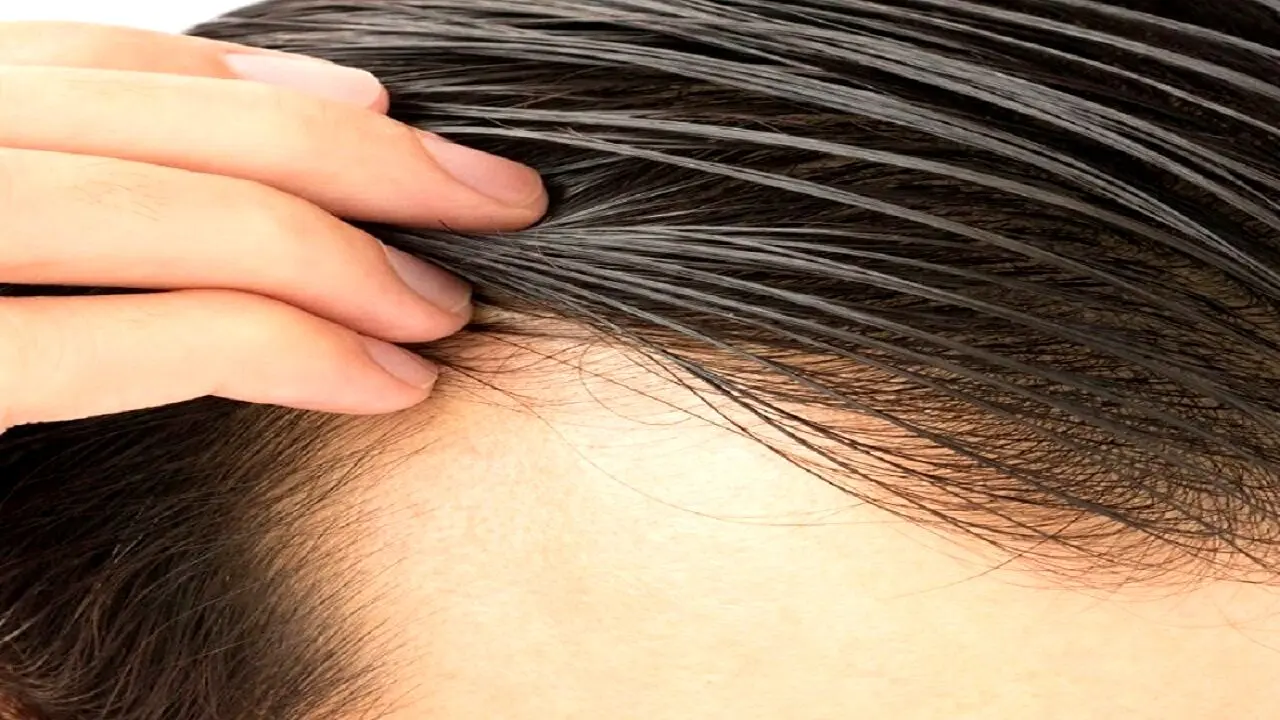 چگونه از آسیب دیدگی موها پیشگیری کنیم؟
