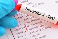 شیوع نگران کننده هپاتیت A در کودکان