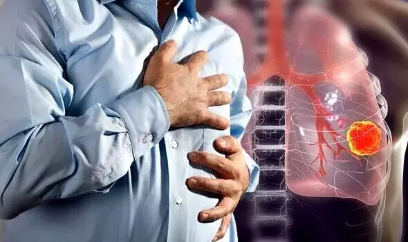 اگر می‌خواهید سرطان ریه نگیرید بخوانید