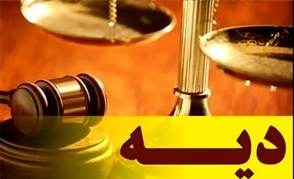 دیه هر عضو بدن انسان چقدر است؟ +عکس