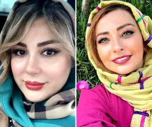 بازیگران زن ایرانی که کتک خوردند! + عکس گریم‌های جنجالی 