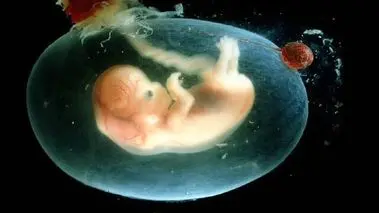 دلایل اصلی سقط‌های عمدی / زوج‌ها تمایلی به فرزندآوری ندارند