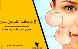 5 راز شگفت انگیز برای درمان چین و چروک دور چشم

