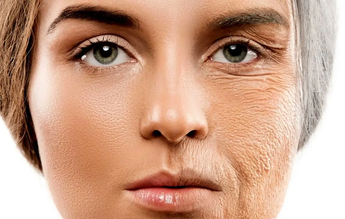 
استرس چه بلایی سر پوست می‌آورد؟