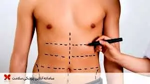 هزینه عجیب  برای باربی شدن  با یک عمل زیبایی!/ شیوع پیکرتراشی در ایران